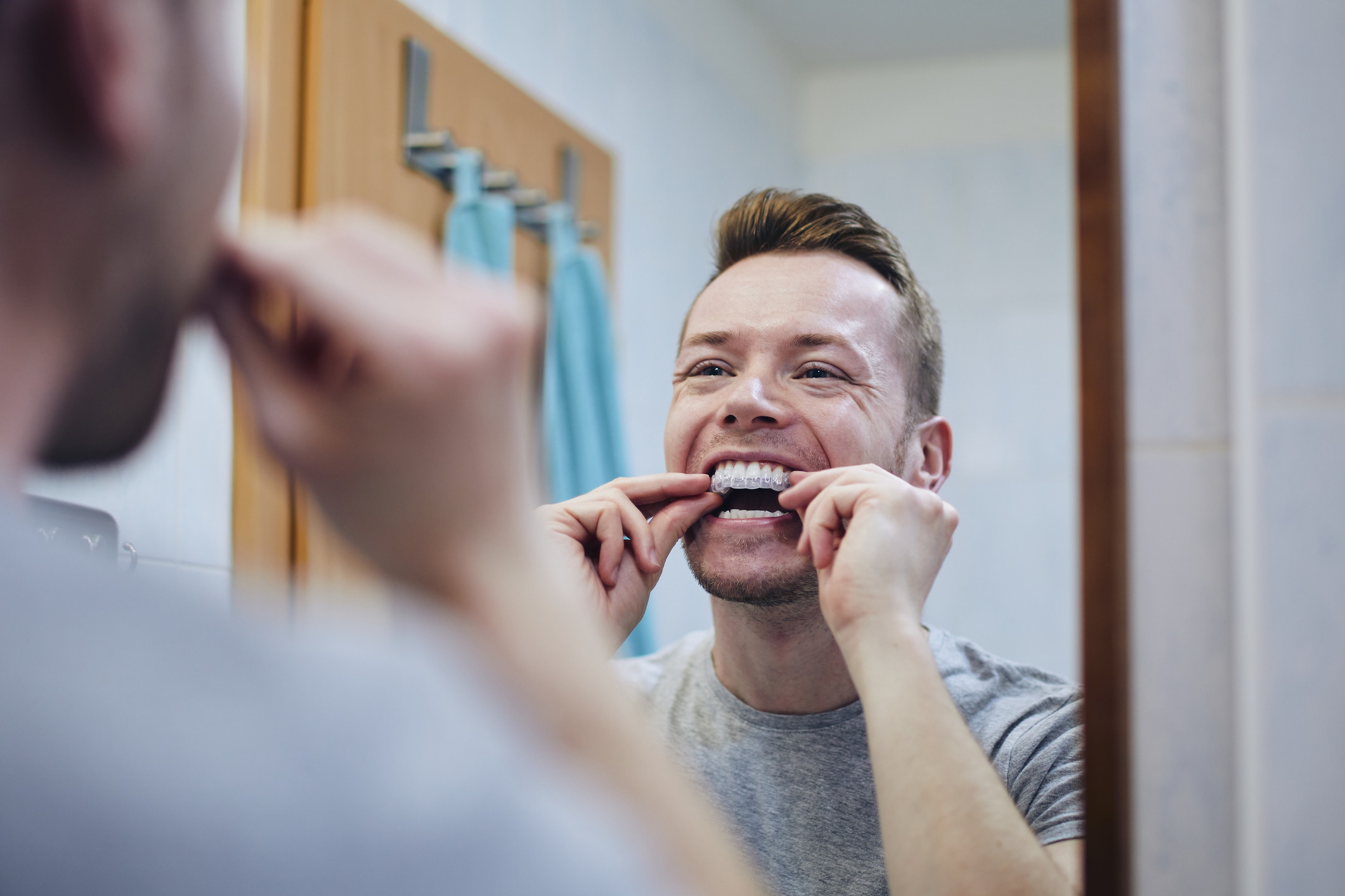 Man putting in clear aligner braces.